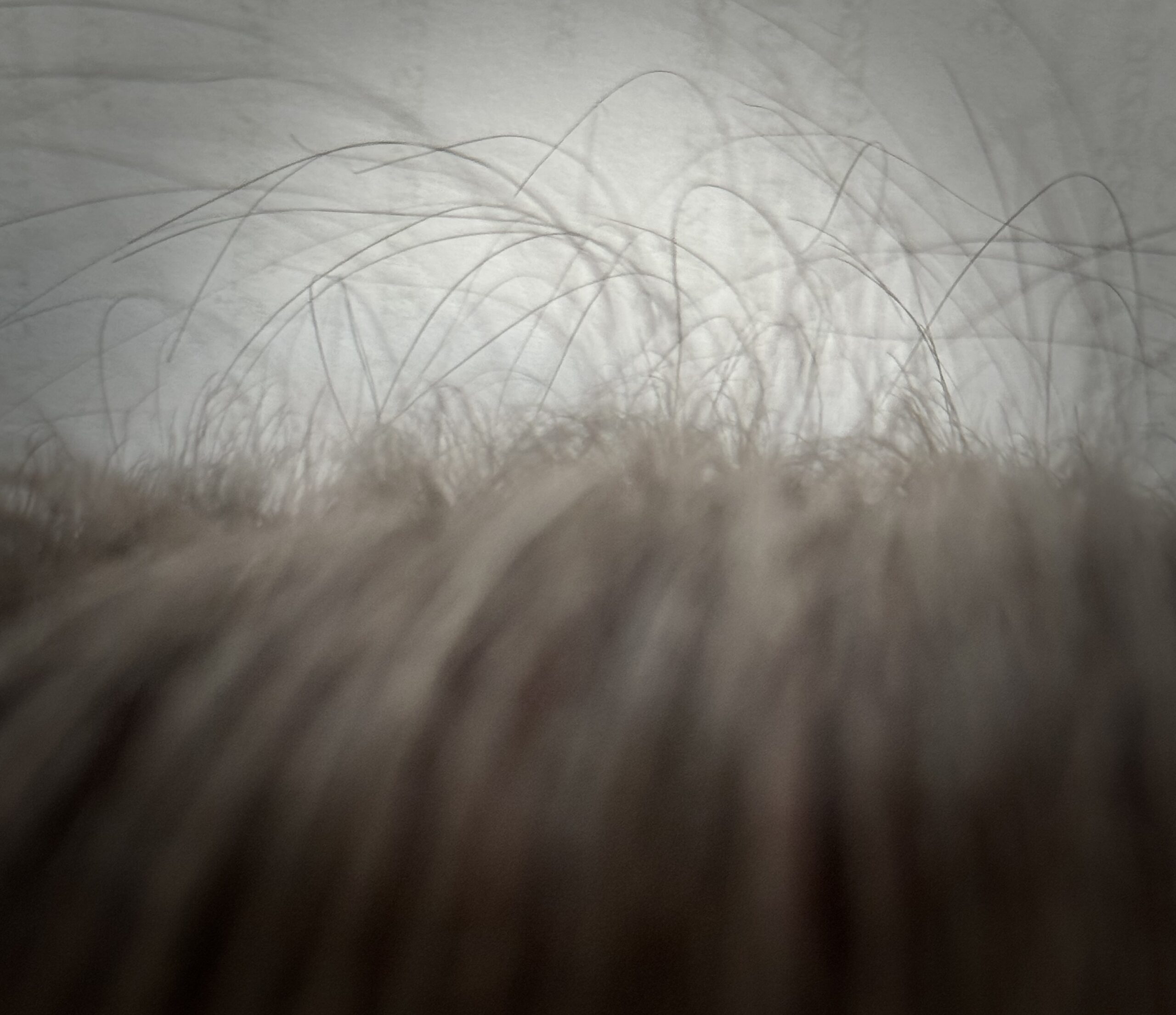 Przypadek z gabinetu: wymagająca skóra i wyzwania zdrowotne - Milena Trycholog Bydgoszcz https://milena-trycholog.pl